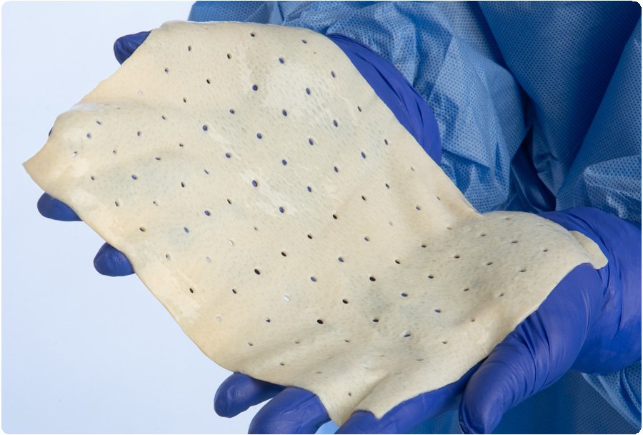 A person with white gloves holding SimpliDerm